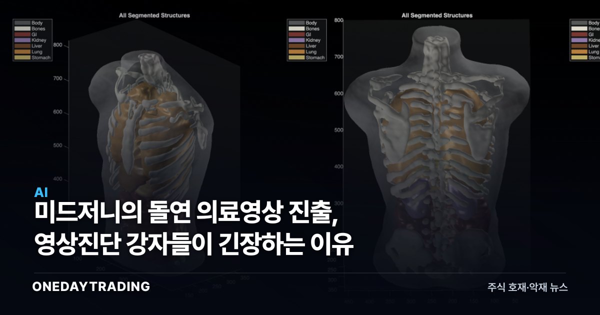 미드저니의 돌연 의료영상 진출, 영상진단 강자들이 긴장하는 이유