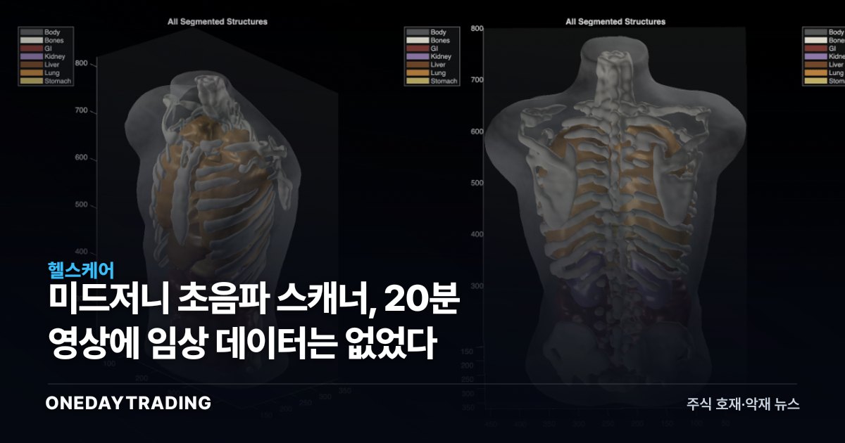 미드저니 초음파 스캐너, 20분 영상에 임상 데이터는 없었다