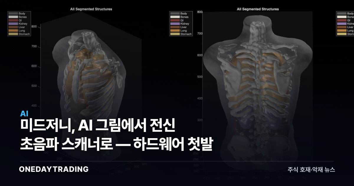미드저니, AI 그림에서 전신 초음파 스캐너로 — 하드웨어 첫발